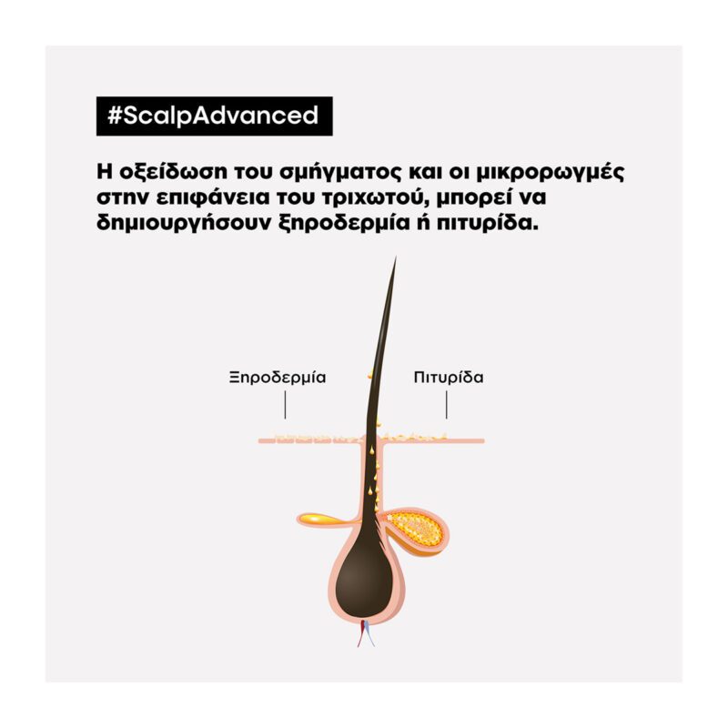 L’Oréal Professionnel Serie Expert Scalp Anti-Dandruff Σαμπουάν Κατά της Πιτυρίδας 300ml - Image 4