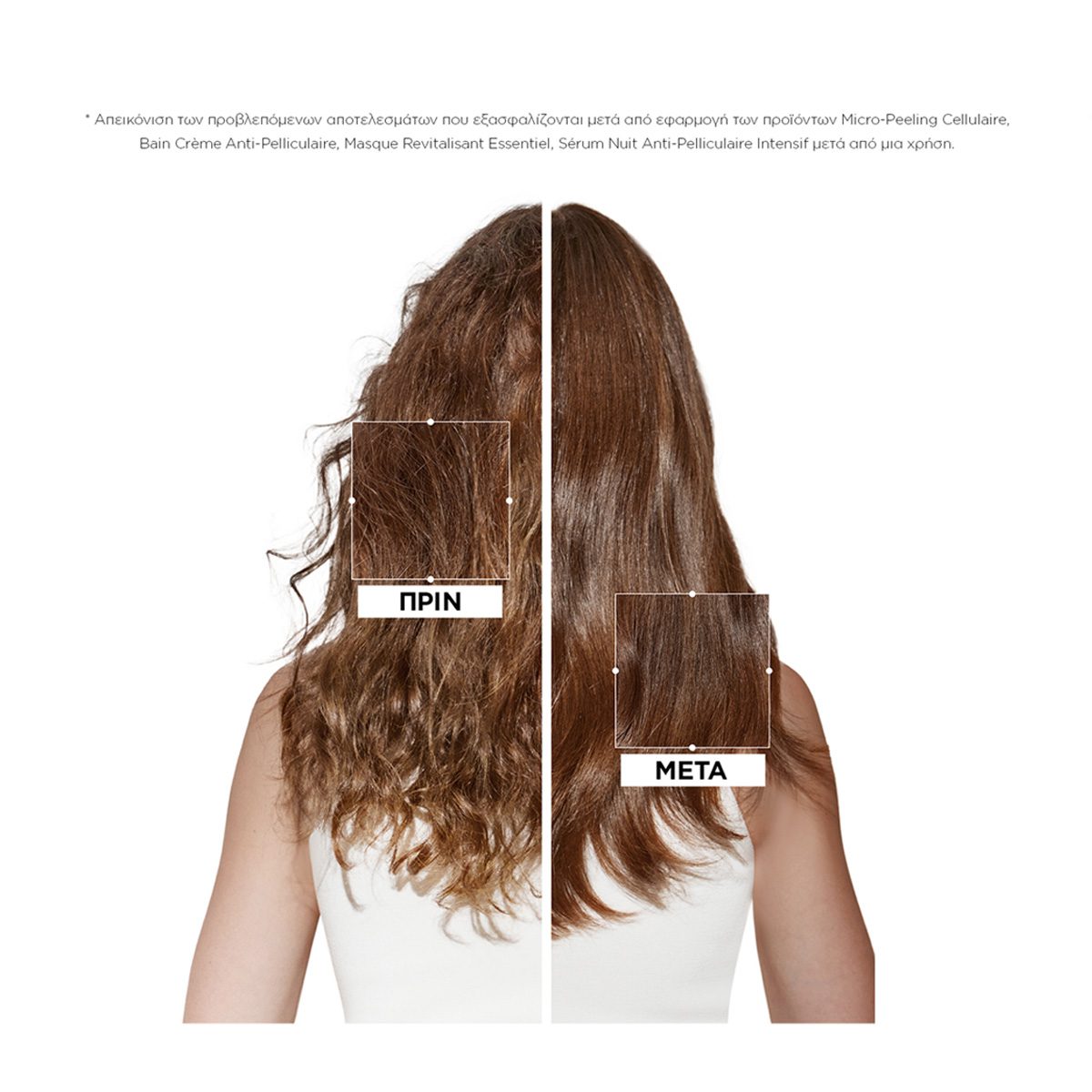 Kérastase Symbiose Micro-Peeling Cellulaire Αντιπιτυριδική Περιποίηση Μικροαπολέπισης 200ml - Image 3