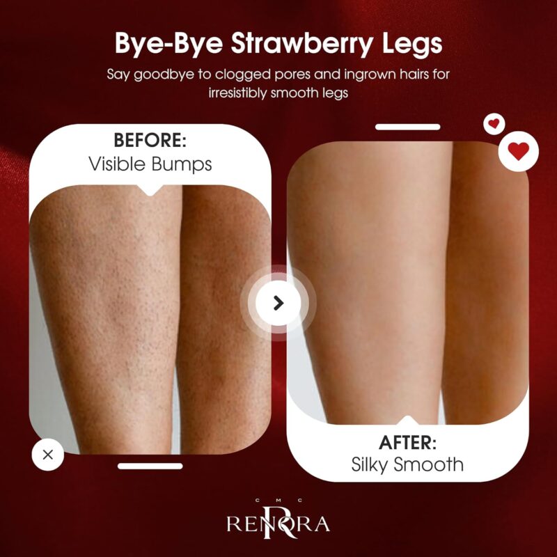 Renora Sugar Touch Natural Body Scrub 250ml – Φυσικό Scrub Σώματος με Ζάχαρη & Έλαια για Βαθιά Απολέπιση & Μεταξένια Απαλότητα - Image 5